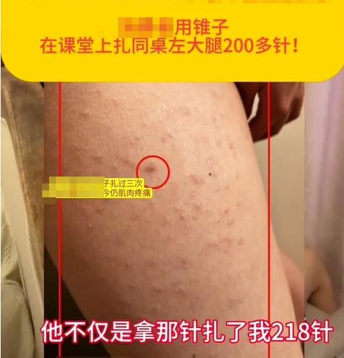 校園防欺凌報(bào)警器：“女生被同桌扎218針”，未達(dá)到校園霸凌標(biāo)準(zhǔn)？多方回應(yīng)